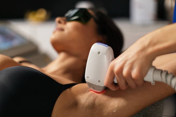 Laser hair removal with Elysion Pro