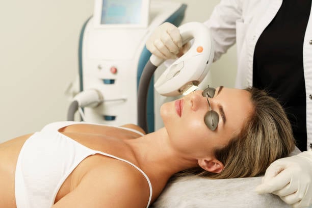 IPL photorejuvenation treatment