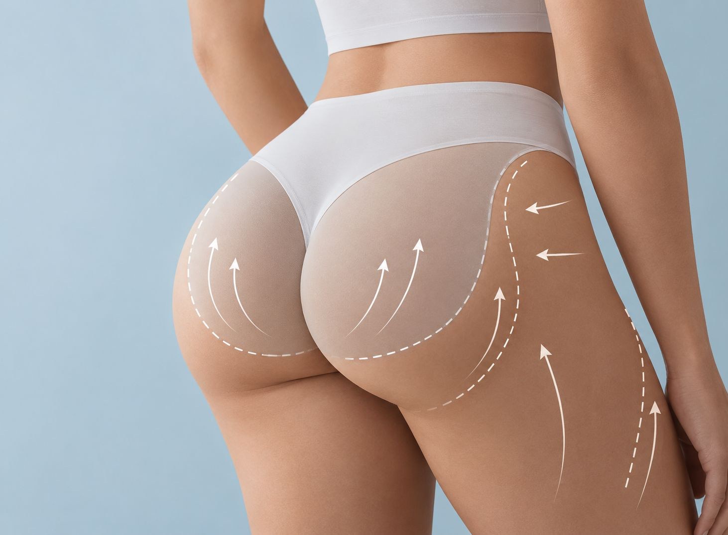 Brazilian Butt Lift
