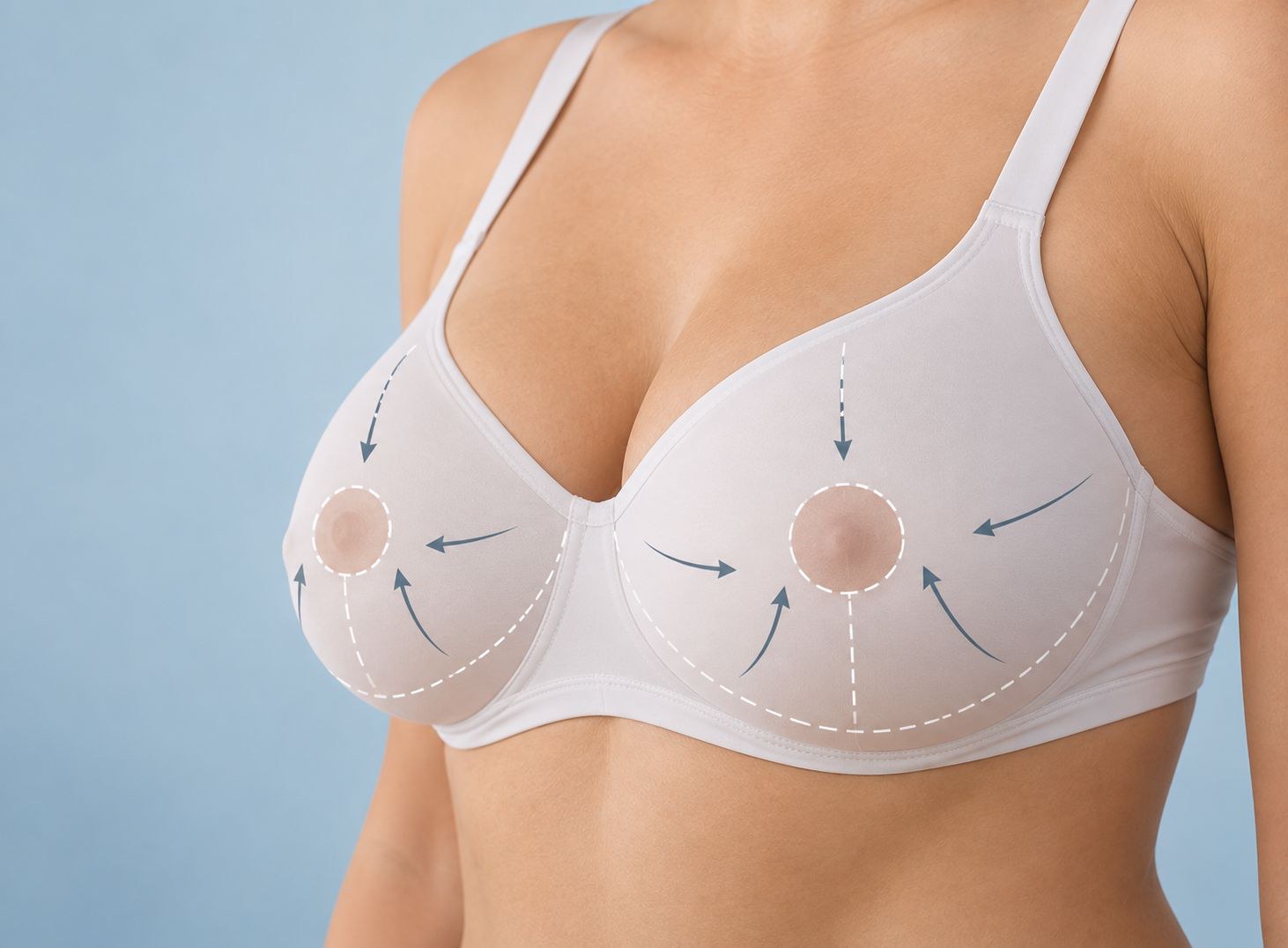 Nipple Reduction